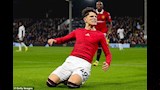 كيف غيرت عمليات التجميل نجوم كرة القدم العالميين؟ 12 - Copy