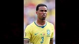 كيف غيرت عمليات التجميل نجوم كرة القدم العالميين؟ 8 - Copy