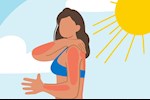  علاج حروق الشمس بالمنزل- 8 طرق طبيعية تخلصك منها      