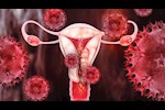 حبوب جديدة قد تمنع سرطان عنق الرحم قبل ظهوره.. علاج علمي واعد