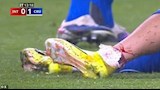 إصابة جابرييل بيك