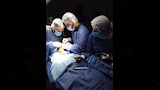 إعادة بناء وجه مريض بعد تفتت عظامه (1)