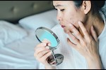أعراض نقص الفيتامينات- 6 علامات تظهر على الوجه احذرها  