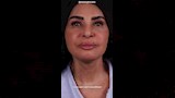سلوى خطاب تخضع لعمليات تجميل (1)