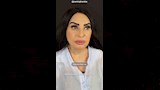 سلوى خطاب بعد عمليات التجميل  (1)