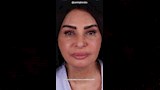 سلوى خطاب تخضع لعمليات تجميل (2)