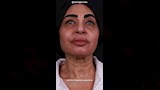 سلوى خطاب تخضع لعمليات تجميل (3)