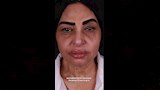 سلوى خطاب قبل عمليات التجميل  (1)