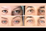 قد تصل للعمى.. استشاري عيون يحذر من مخاطر عمليات تغيير لون العين