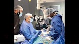 عمليات زراعة القوقعة