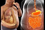  علاج الدهون الحشوية- تناول هذه الأطعمة للتخلص منها    