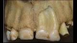 دراسات أسنان المومياوات