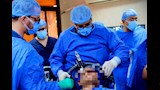 نجاح جراحة التحفيز العميق للمخ لشاب بجامعة أسيوط (2)