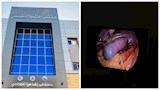 لأول مرة.. مستشفى إهناسيا التخصصي يجري استئصال الطحال بالمنظار لمريضة 59 عامًا