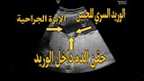 جامعة أسيوط تنجح في علاج جنين 