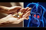 هذه المكملات الغذائية قد تسبب مشاكل صحية عند مريض الكلى.. احذر