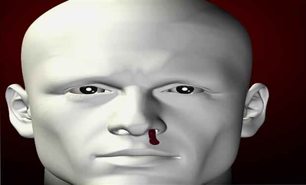 الغلوكوزامين مع الكومارين قد يتسببان في حدوث نزيف