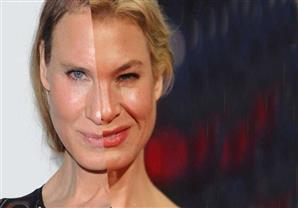 بالصور: نجوم تغيرت ملامحهم من بينهم مصريين