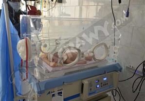 الأولى من نوعها.. جراحة ناجحة لرضيعة بعمر 7 أيام في مستشفى العريش العام