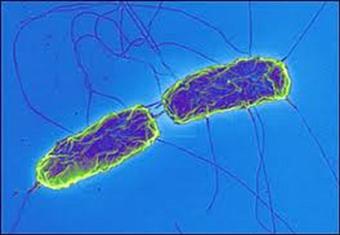 صحة أسوان تنفي وجود حالات مصابة بالتيفود