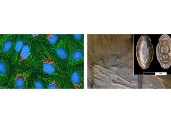 شاب سوداني ''أقدم مصاب بالسرطان في العالم''