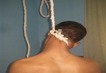 انتحار فلاح شنقًا في المنوفية