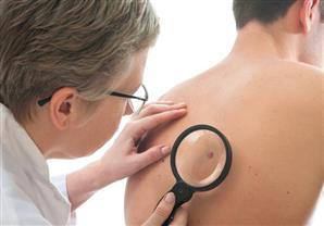 الأشعة فوق البنفسجية تهددك بسرطان الجلد! 