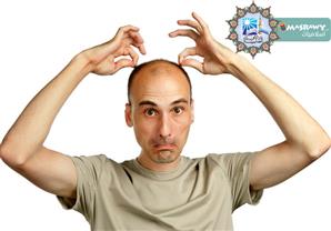 ما حكم زرع الشعر لمن عنده صلع في رأسه؟