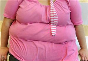 استشاري تغذية : المرأة المصرية ستكون الأعلى بدانة عالميًا بحلول 2025