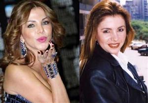 بالصور: أشهر المذيعات قبل وبعد عمليات التجميل