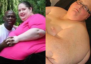 قصص أضخم أشخاص حول العالم..وكيف فقدوا الوزن