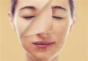 أفضل 10 أطعمة للحد من جفاف الجلد في الشتاء