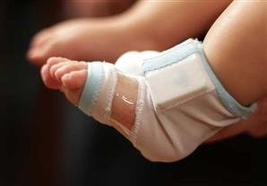 الجوارب الذكية للرضع مفيدة لكن لا تخلو من المخاطر