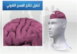دراسة: التدخين يؤثر على وظائف المخ