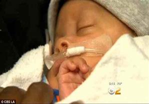 بالصور- "معجزة طبية".. ولادة طفل داخل "المشيمة"