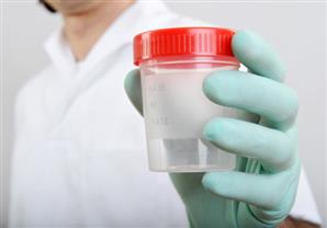 جودة السائل المنوي ترتبط بالصحة العامة للرجل