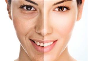 عوامل شحوب الوجه وحلولها ..اكتشفِ