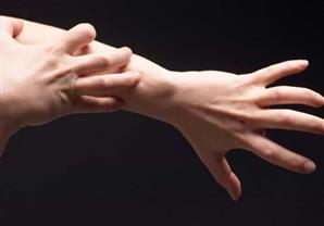 تعددت الأسباب والمرض واحد: الحساسية تثير حيرة الخبراء