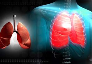 أفضل الأطعمة للوقاية من سرطان الرئة.. اكتشف