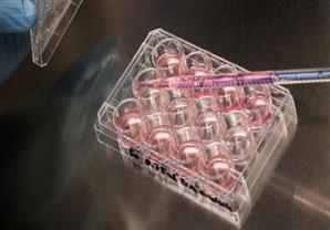 صحيفة: مستشفيات هولندية ترفض علاج الخصوبة للنساء غير المتزوجات