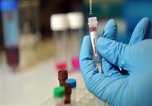 النيابة تأمر بإجراء تحليل البصمة الوراثية لـ"هيكلين عظميين" عثر عليهما ببولاق الدكرور