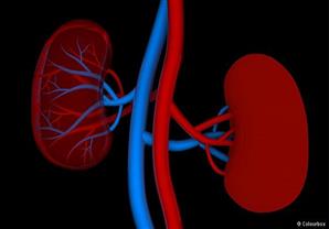 حصى الكلى.. أعراضها وطرق علاجها