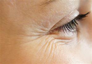 ماسك فعال للتجاعيد حول منطقة العين .. اكتشف