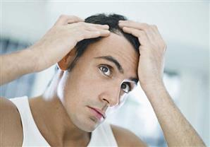 للرجال: أطعمة للحماية من الصلع