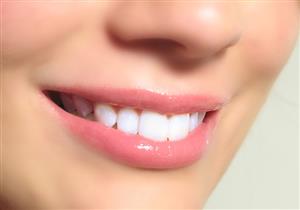 من أجل أسنان بيضاء تجنبوا هذه الأطعمة والمشروبات