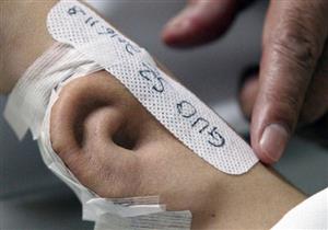 بالصور.. أطباء يزرعون أذناً في ذراع مريض.. والسبب!