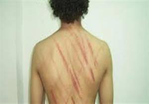 "ضحية التعذيب" بأسيوط: 25 فردا ضربوني و"عروني" ولم يدافع أحد عني