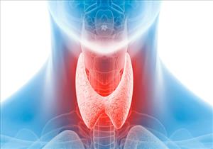 علامات تكشف وجود مشكلات في الغدة الدرقية.. منها قلة النوم