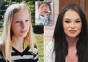 فتاة تصبح أجمل بعد فقدانها وجهها الحقيقي في حادث! اكتشف