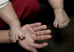 بالصور.. طفل يولد بـ 31 إصبعًا!